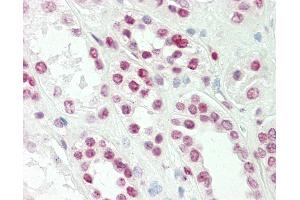 Image no. 2 for anti-T-Cell Leukemia Homeobox 1 (TLX1) (AA 163-191) antibody (ABIN1942238)