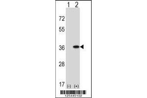 Image no. 2 for anti-Guanine Nucleotide Binding Protein (G Protein), Q Polypeptide (GNAQ) (AA 52-78), (N-Term) antibody (ABIN5535218)