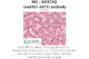 Image no. 2 for anti-Notch 2 (NOTCH2) (AA 2457-2471) antibody (ABIN1737435)