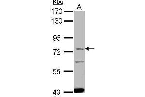 Image no. 1 for anti-Solute Carrier Family 27 (Fatty Acid Transporter), Member 4 (SLC27A4) (Center) antibody (ABIN2854876)