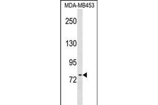 POMT2 antibody  (C-Term)