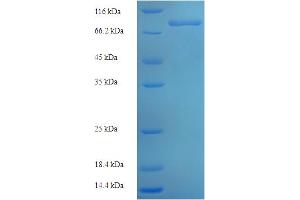 Image no. 1 for Zinc Finger Protein 155 (ZNF155) (AA 1-538), (full length) protein (His-SUMO Tag) (ABIN5710644)