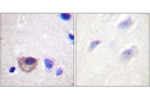 Image no. 2 for anti-Dynein, Axonemal, Heavy Chain 8 (DNAH8) (AA 5-54) antibody (ABIN1532320)