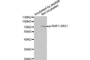 Image no. 1 for anti-V-Raf-1 Murine Leukemia Viral Oncogene Homolog 1 (RAF1) (pSer621) antibody (ABIN3019551)
