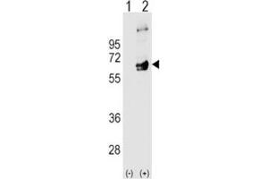 Image no. 1 for anti-FYN Oncogene Related To SRC, FGR, YES (FYN) (AA 13-43) antibody (ABIN3031009)