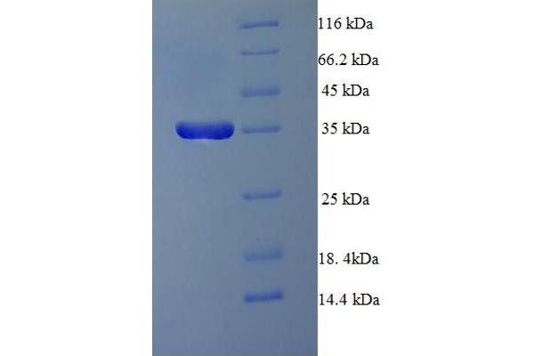 PPP2R3B Protein (AA 1-176) (His-SUMO Tag)