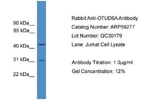 Image no. 1 for anti-OTU Domain Containing 6A (OTUD6A) (Middle Region) antibody (ABIN2788002)