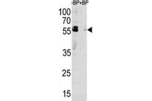 Image no. 4 for anti-Sequestosome 1 (SQSTM1) (AA 317-346) antibody (ABIN3031543)