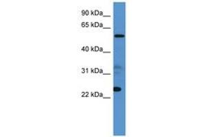 Image no. 1 for anti-Copine IX (CPNE9) (AA 359-408) antibody (ABIN6746107)