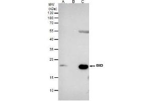 IP Image Bid antibody [N1C3] immunoprecipitates BID protein in IP experiments.