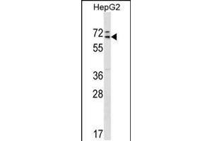 Image no. 1 for anti-Mediator Complex Subunit 26 (MED26) (AA 191-220) antibody (ABIN5533369)