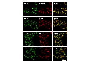 Image no. 3 for anti-Lysosomal-Associated Membrane Protein 1 (LAMP1) antibody (ABIN361797)