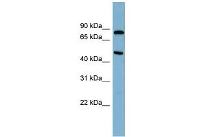 Image no. 2 for anti-Pantothenate Kinase 4 (PANK4) (N-Term) antibody (ABIN2787088)