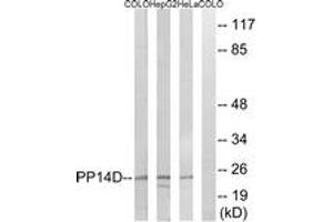 Image no. 1 for anti-Protein Phosphatase 1, Regulatory (Inhibitor) Subunit 14D (PPP1R14D) (AA 66-115) antibody (ABIN1535220)