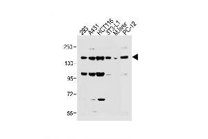 Image no. 5 for anti-Insulin Receptor (INSR) (AA 28-57), (N-Term) antibody (ABIN392002)