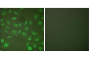 Immunofluorescence analysis of HepG2 cells, using C/EBP-beta (Phospho-Thr235/188) Antibody.