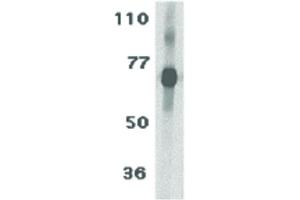 Image no. 2 for anti-Interleukin 27 Receptor, alpha (IL27RA) (N-Term) antibody (ABIN6655153)