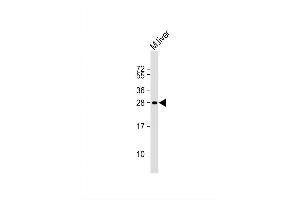 Image no. 2 for anti-Suppressor of IKBKE 1 (SIKE1) (AA 36-63), (N-Term) antibody (ABIN1881808)
