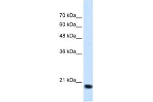 Image no. 1 for anti-Signal Sequence Receptor, beta (Translocon-Associated Protein Beta) (SSR2) antibody (ABIN2462852)