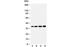 HSD17B1 Antikörper  (AA 29-43)