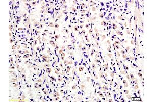 Image no. 2 for anti-Tuberous Sclerosis 2 (TSC2) (AA 1601-1750) antibody (ABIN701200)