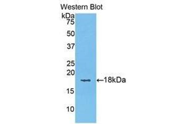 anti-Keratin 6A (KRT6A) (AA 323-461) antibody