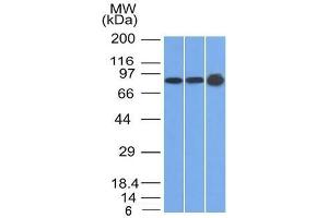 Image no. 1 for anti-Plakophilin 1 (PKP1) (N-Term) antibody (ABIN6940317)