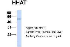 Image no. 3 for anti-Hedgehog Acyltransferase (HHAT) (N-Term) antibody (ABIN2782948)
