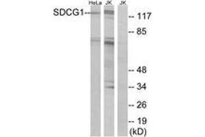 Image no. 1 for anti-serologically Defined Colon Cancer Antigen 1 (SDCCAG1) (AA 881-930) antibody (ABIN1533523)