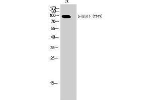 Image no. 1 for anti-Epidermal Growth Factor Receptor Pathway Substrate 15 (EPS15) (pTyr849) antibody (ABIN3182362)