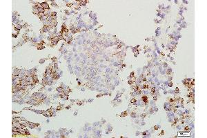 Image no. 2 for anti-Osteoactivin (GPNMB) (AA 81-180) antibody (ABIN749093)