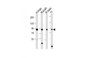 Image no. 4 for anti-Doublecortin-Like Kinase 1 (DCLK1) (AA 690-720) antibody (ABIN391324)