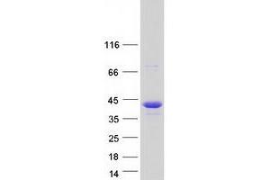Image no. 1 for Nucleoporin 35kDa (NUP35) protein (Myc-DYKDDDDK Tag) (ABIN2727810)