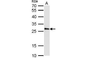 WB Image COMT antibody detects COMT protein by Western blot analysis.
