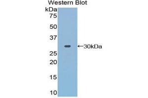 Image no. 1 for anti-Toll Interacting Protein (TOLLIP) (AA 28-261) antibody (ABIN1860826)