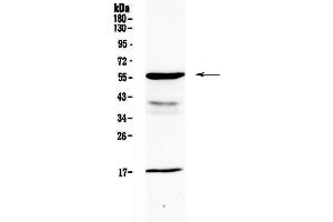 Image no. 6 for anti-Galactosamine (N-Acetyl)-6-Sulfate Sulfatase (GALNS) (AA 181-289) antibody (ABIN5693230)