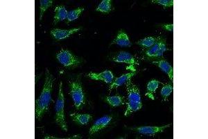 Immunofluorescent analysis of Swiprosin-2 staining in Hela cells.
