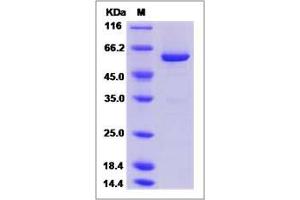 Image no. 1 for Protein tyrosine Phosphatase, Non-Receptor Type 9 (PTPN9) (AA 285-593) protein (His tag,GST tag) (ABIN2004316)