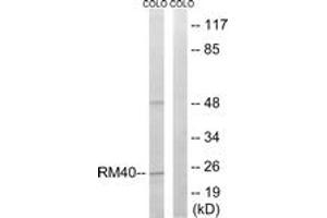 Image no. 1 for anti-Mitochondrial Ribosomal Protein L40 (MRPL40) (AA 101-150) antibody (ABIN1534529)