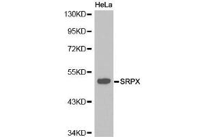 Image no. 1 for anti-Sushi-Repeat Containing Protein, X-Linked (SRPX) antibody (ABIN3021753)
