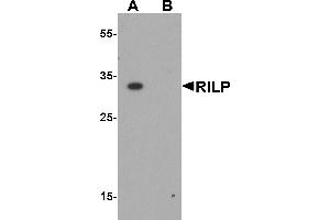 Western blot analysis of RILP in HeLa cell lysate with RILP antibody at 1 µg/mL in (A) the absence and (B) the presence of blocking peptide.