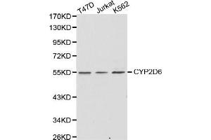 Western Blotting (WB) image for anti-Cytochrome P450, Family 2, Subfamily D, Polypeptide 6 (CYP2D6) (AA 20-230) antibody (ABIN1512811)
