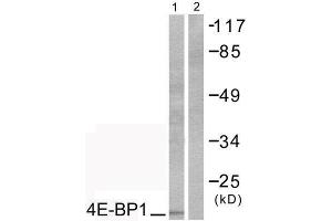Image no. 2 for anti-Eukaryotic Translation Initiation Factor 4E Binding Protein 1 (EIF4EBP1) (Thr70) antibody (ABIN1847930)