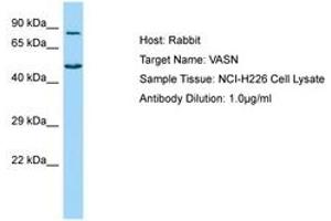 Image no. 1 for anti-Vasorin (Vasn) (AA 521-570) antibody (ABIN6750146)