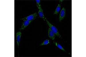 Image no. 1 for anti-Heat Shock 70kDa Protein 4 (HSPA4) antibody (ABIN5580253)