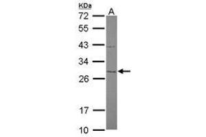 Image no. 1 for anti-Mitochondrial Translational Initiation Factor 3 (MTIF3) (AA 1-203) antibody (ABIN1499584)