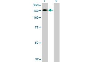 Image no. 1 for anti-ADAM Metallopeptidase with thrombospondin Type 1 Motif, 18 (ADAMTS18) (AA 1-1221) antibody (ABIN531219)