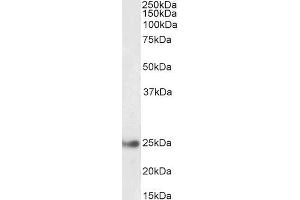 Image no. 1 for anti-Glutathione S-Transferase alpha 4 (GSTA4) (Internal Region) antibody (ABIN5539848)