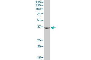 SHOX antibody  (AA 1-225)