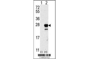 Image no. 2 for anti-GTPase NRas (NRAS) (AA 72-101), (N-Term) antibody (ABIN392152)